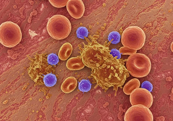 Conceptual immune cells mistakenly attacking body's own cells.